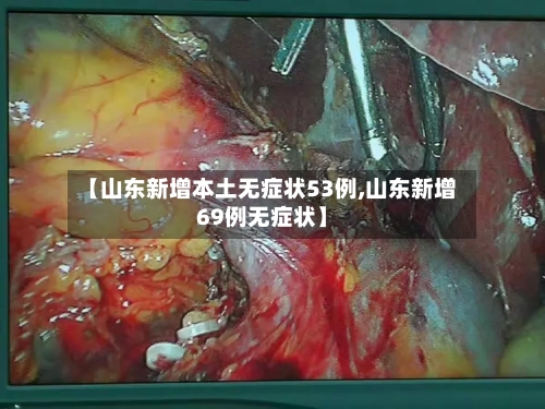 【山东新增本土无症状53例,山东新增69例无症状】-第2张图片
